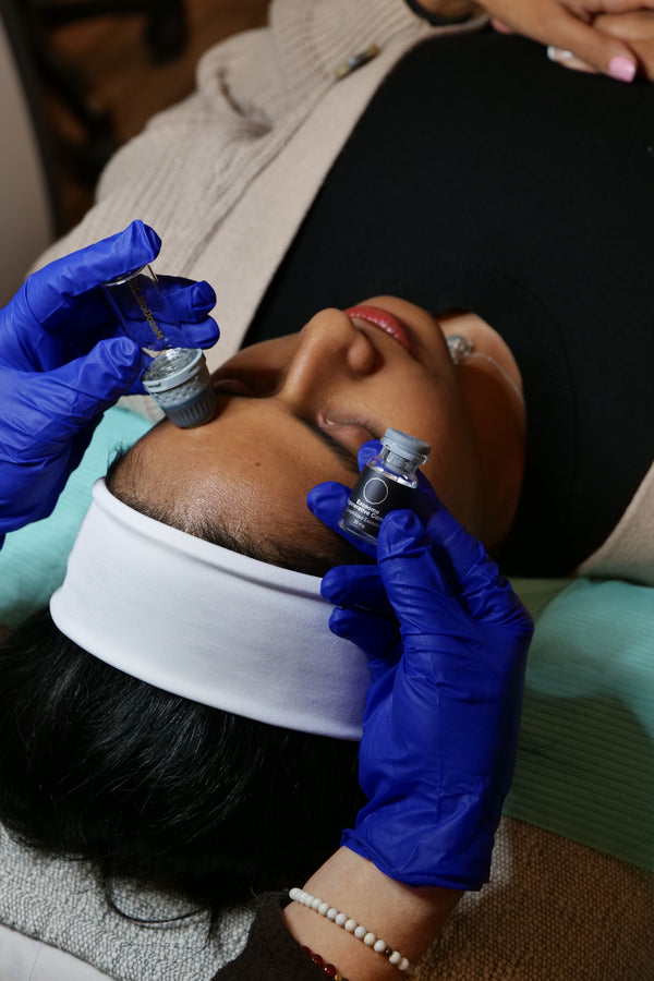 Exosome Microneedling Facial