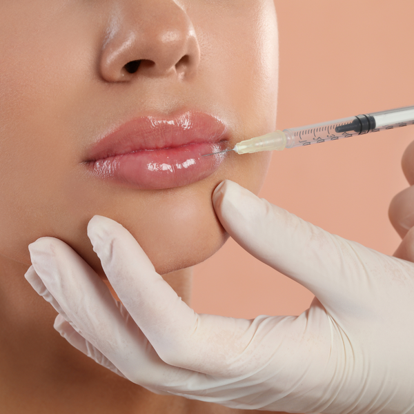 Lip Fillers- Valentine's Promotion